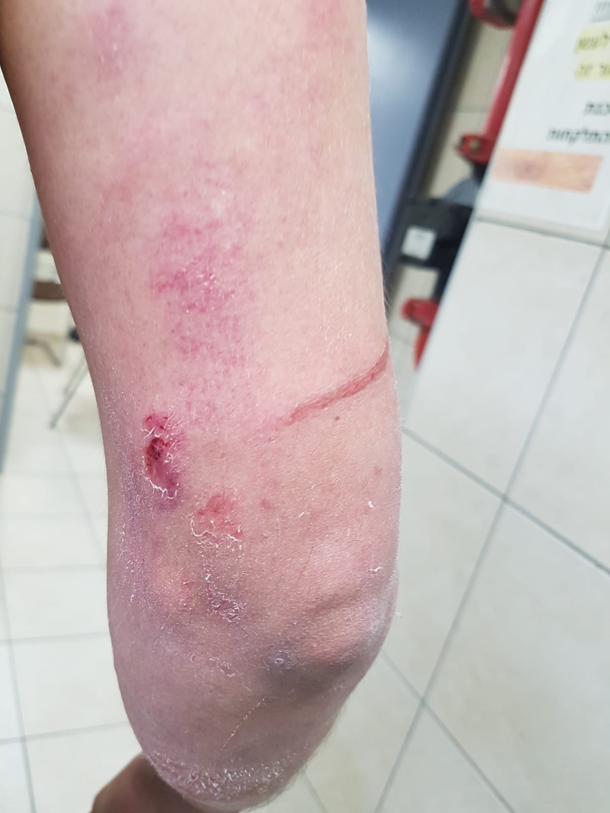 WhatsApp Image 2021-05-12 at 12.30.54 PM (2).jpeg